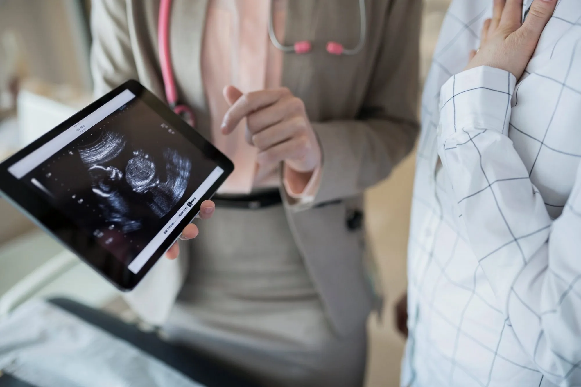ultrasonic scan of a baby